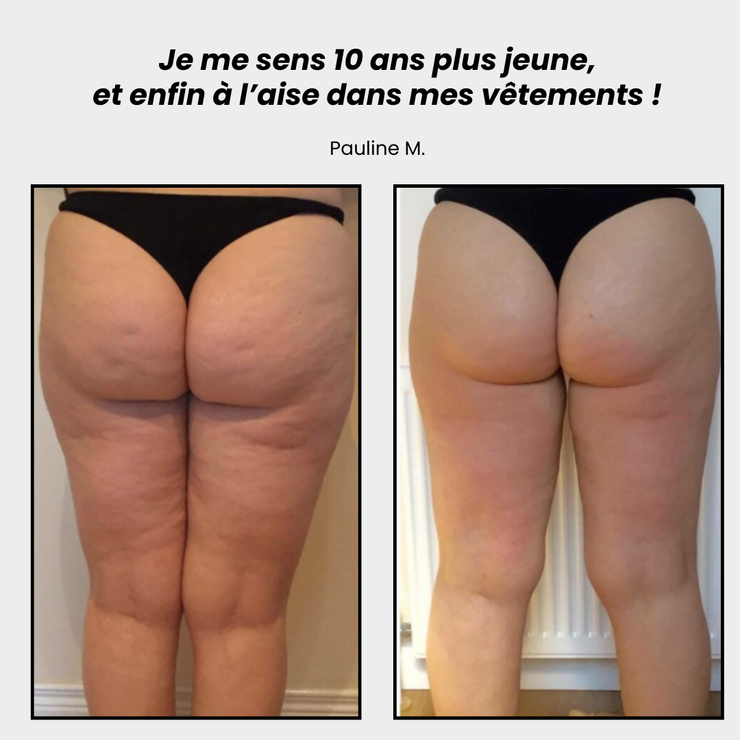 Legging 3D PRO Anti-cellulite